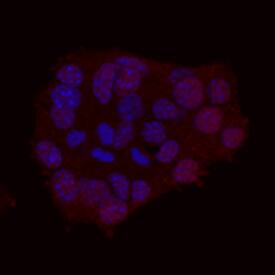 NeuroD1 antibody in  betaTC-6 Mouse Cell Line by Immunocytochemistry (ICC).