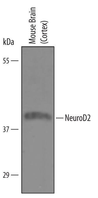 Detection of Mouse NeuroD2 antibody by Western Blot.