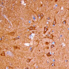 Neurocan antibody in Human Brain by Immunohistochemistry (IHC-P).