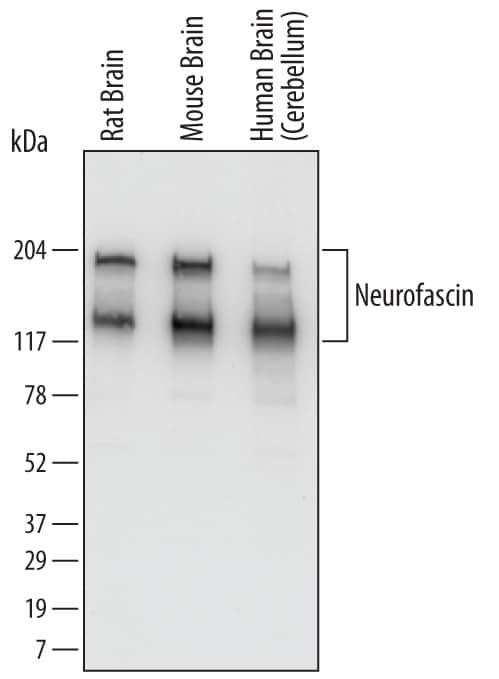 Detection of Human, Mouse, and Rat Neurofascin antibody by Western Blot.