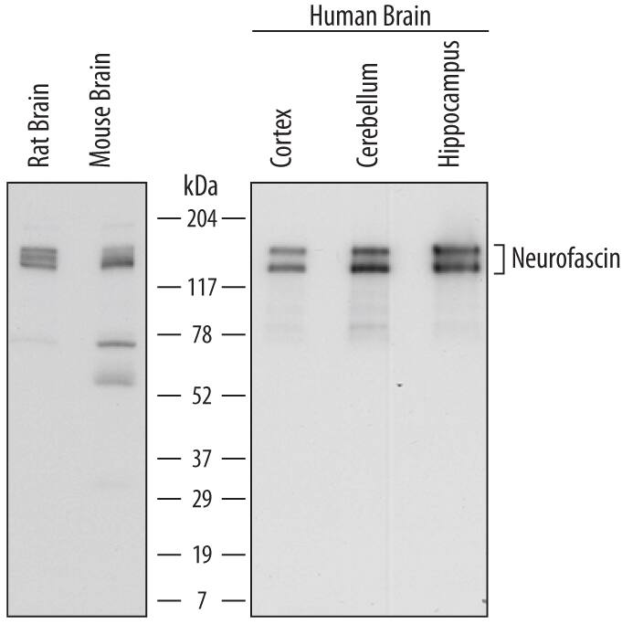 Detection of Human, Mouse, and Rat Neurofascin antibody by Western Blot.