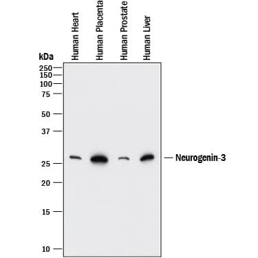 Detection of Human Neurogenin-3 antibody by Western Blot.