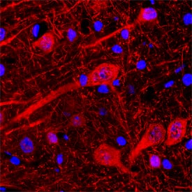 Neuroligin 1/NLGN1 antibody in Rat Brain by Immunohistochemistry (IHC-Fr).