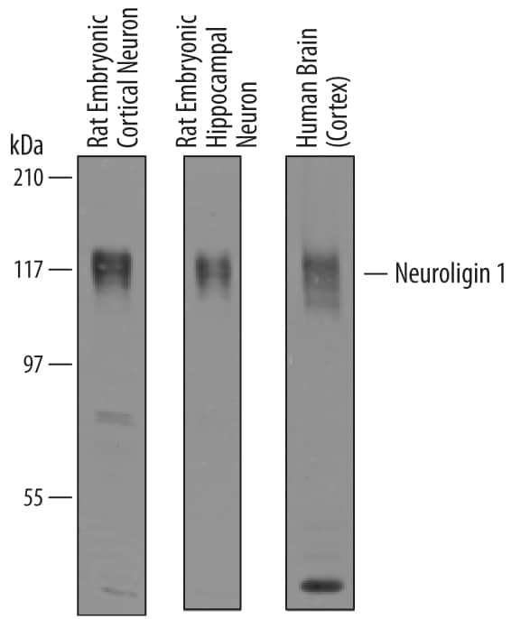 Detection of Human and Rat Neuroligin 1/ NLGN1 antibody by Western Blot.