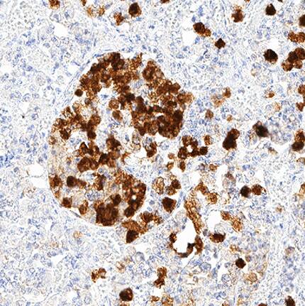 Neuronal Pentraxin 2 antibody in Human Pituitary Tissue by Immunohistochemistry (IHC-P).