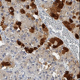 Neuronal Pentraxin 2 antibody in Human Pituitary by Immunohistochemistry (IHC-P).