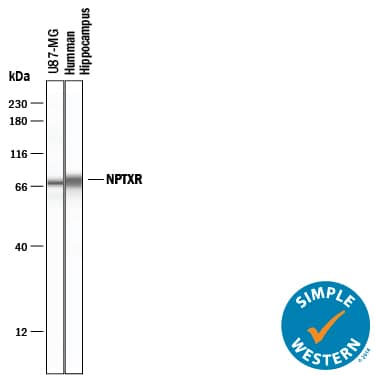 Detection of Human Neuronal Pentraxin R/NPTXR antibody by Simple WesternTM.