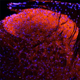 Neuropilin-1 antibody in Rat Spinal Cord by Immunohistochemistry (IHC-Fr).