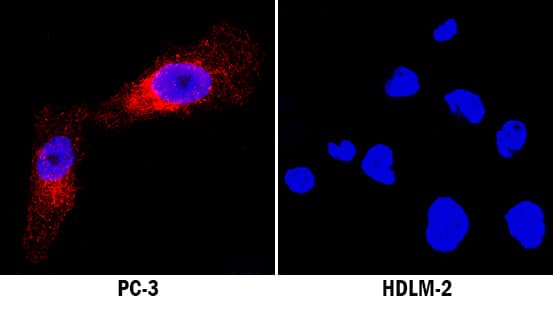 Neuropilin-1 antibody in PC-3 and HLDM-2 Human Cell Lines by Immunocytochemistry (ICC).