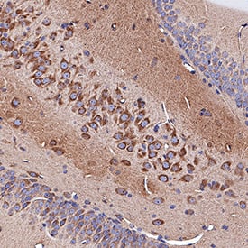 Neuropilin-1 antibody in Rat Brain by Immunohistochemistry (IHC-P).