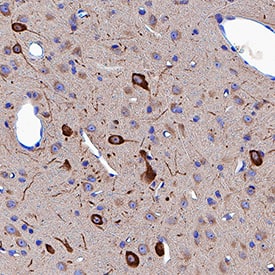 Neuropilin-1 antibody in Rat Brain by Immunohistochemistry (IHC-P).
