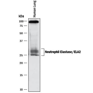 Detection of Human Neutrophil Elastase/ELA2 antibody by Western Blot.