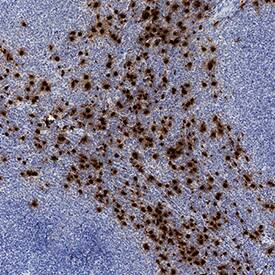 Human Neutrophil Elastase/ELA2 Antibody (MAB91671) by R&D