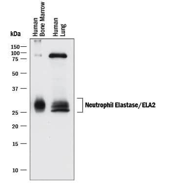 Detection of Human Neutrophil Elastase/ELA2 antibody by Western Blot.