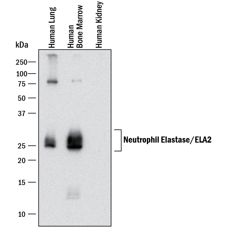 Detection of Human Neutrophil Elastase/ELA2 antibody by Western Blot.