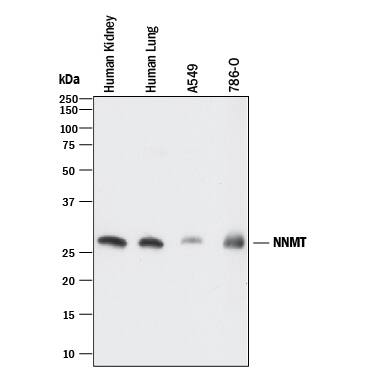 Detection of Nicotinamide N-Methyltransferase/NNMT antibody by Western Blot.