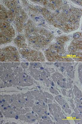 Nidogen-1/Entactin antibody in Human Heart by Immunohistochemistry (IHC-P).