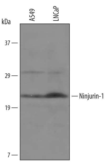 Detection of Human Ninjurin-1 antibody by Western Blot.