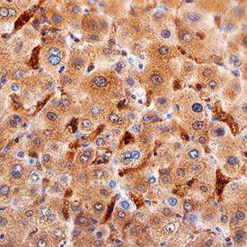 Ninjurin-1 antibody in Human Liver by Immunohistochemistry (IHC-P).