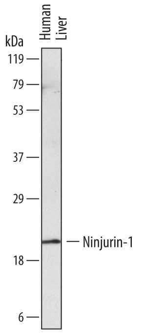 Detection of Human Ninjurin-1 antibody by Western Blot.