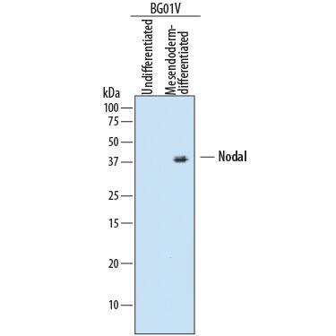 Detection of Human Nodal antibody by Western Blot.