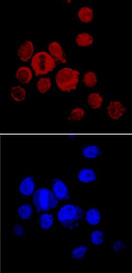 Noggin antibody in PC-3 Human Cell Line by Immunocytochemistry (ICC).