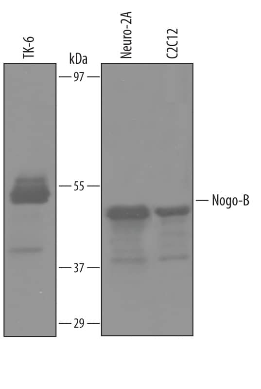 Detection of Human and Mouse Nogo-B antibody by Western Blot.