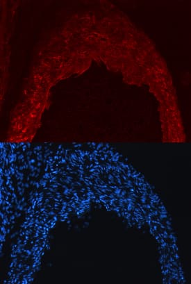 Nogo-B antibody in Mouse Heart by Immunohistochemistry (IHC-Fr).