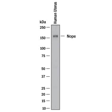 Detection of Human Nope/IGDCC4 antibody by Western Blot.