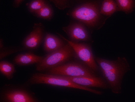 Notch-1 antibody in Saos-2 Human Cell Line by Immunocytochemistry (ICC).