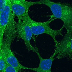 Notch-1 antibody in Mouse Cortical Stem Cells by Immunocytochemistry (ICC).