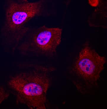 Notch-4 antibody in Human HUVEC by Immunocytochemistry (ICC).