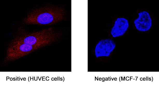 Nox4 antibody in HUVECs by Immunocytochemistry (ICC).