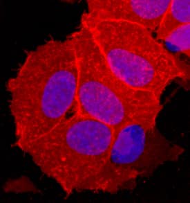 OBCAM/OPCML antibody in MCF-7 Human Cell Line by Immunocytochemistry (ICC).