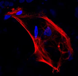 OV-6 antibody in BG01V Human Embryonic Stem Cells by Immunocytochemistry (ICC).