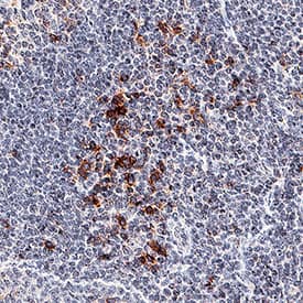 OX40/TNFRSF4 antibody in Human Tonsil by Immunohistochemistry (IHC-P).