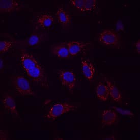 Occludin antibody in HUVEC Human Cells by Immunocytochemistry (ICC).