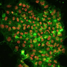 Alkaline Phosphatase and Oct-3/4 antibody in BG01V Human Stem Cells by Immunocytochemistry (ICC).