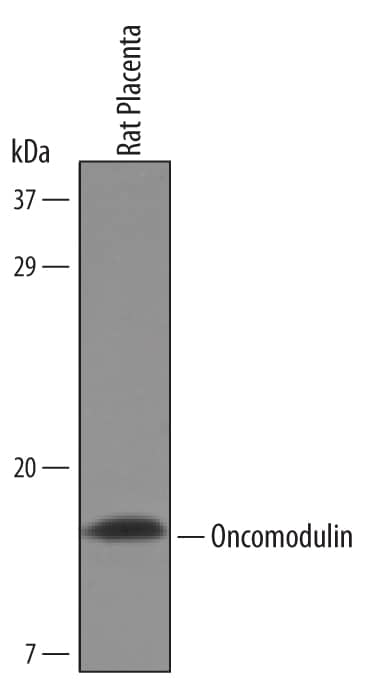 Detection of Rat Oncomodulin antibody by Western Blot.