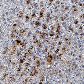 Ornithine Carbamoyltransferase/OTC antibody in Human Liver by Immunohistochemistry (IHC-P).