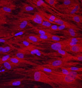 Osteoadherin/OSAD antibody in Human Mesenchymal Stem Cells by Immunocytochemistry (ICC).