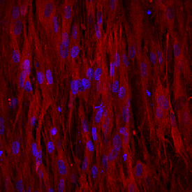 Osteocalcin antibody in Human Osteocytes by Immunocytochemistry (ICC).