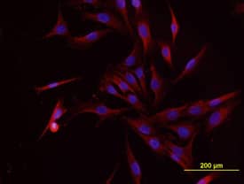 Osteocalcin antibody in MG-63 Human Cell Line by Immunocytochemistry (ICC).