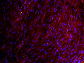 Osteocalcin antibody in Rat Osteocytes by Immunocytochemistry (ICC).