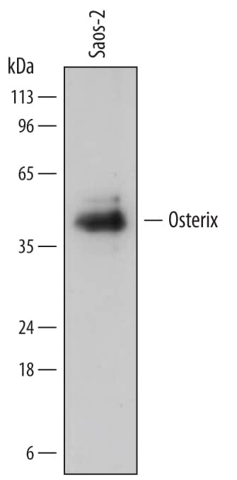 Detection of Human Osterix/Sp7 antibody by Western Blot.