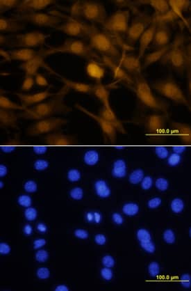 Otx2 antibody in NTera-2 Human Cell Line by Immunocytochemistry (ICC).