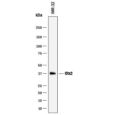 Detection of Human Otx2 antibody by Western Blot.