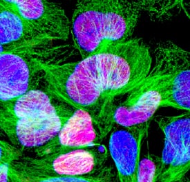 Otx2 antibody in BG01V Human Embryonic Stem Cells by Immunocytochemistry (ICC).