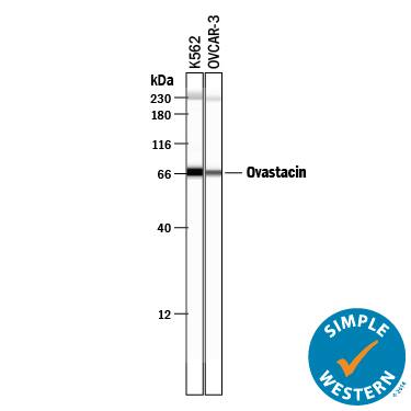 Detection of Human Ovastacin antibody by Simple WesternTM.