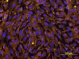 E-Selectin (CD62E)/P-Selectin (CD62P) antibody in HUVEC Human Cells by Immunocytochemistry (ICC).